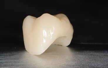 Zahnarztpraxis Dentalfitness CEREC Vollkeramikkrone