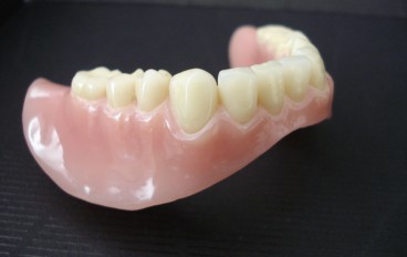 Zahnarztpraxis Dentalfitness Unterkiefertotalprothese