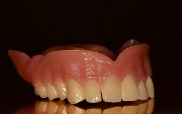 Zahnarztpraxis Dentalfitness Oberkiefertotalprothese