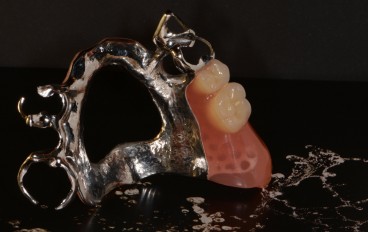 Zahnarztpraxis Dentalfitness Modellgussteilprothese