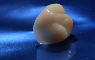 Zahnarztpraxis Dentalfitness Cerec Vollkeramikkrone