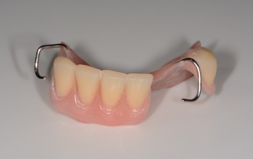 Zahnarztpraxis Dentalfitness Drahtklammerteilprothese