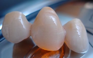Zahnarztpraxis Dentalfitness Brücke